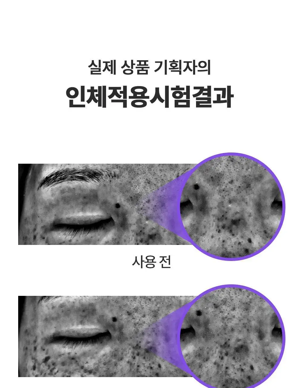 [잡티미백케어] 성분에디터 머루포도 비타 C 잡티크림 50g 상세페이지 20